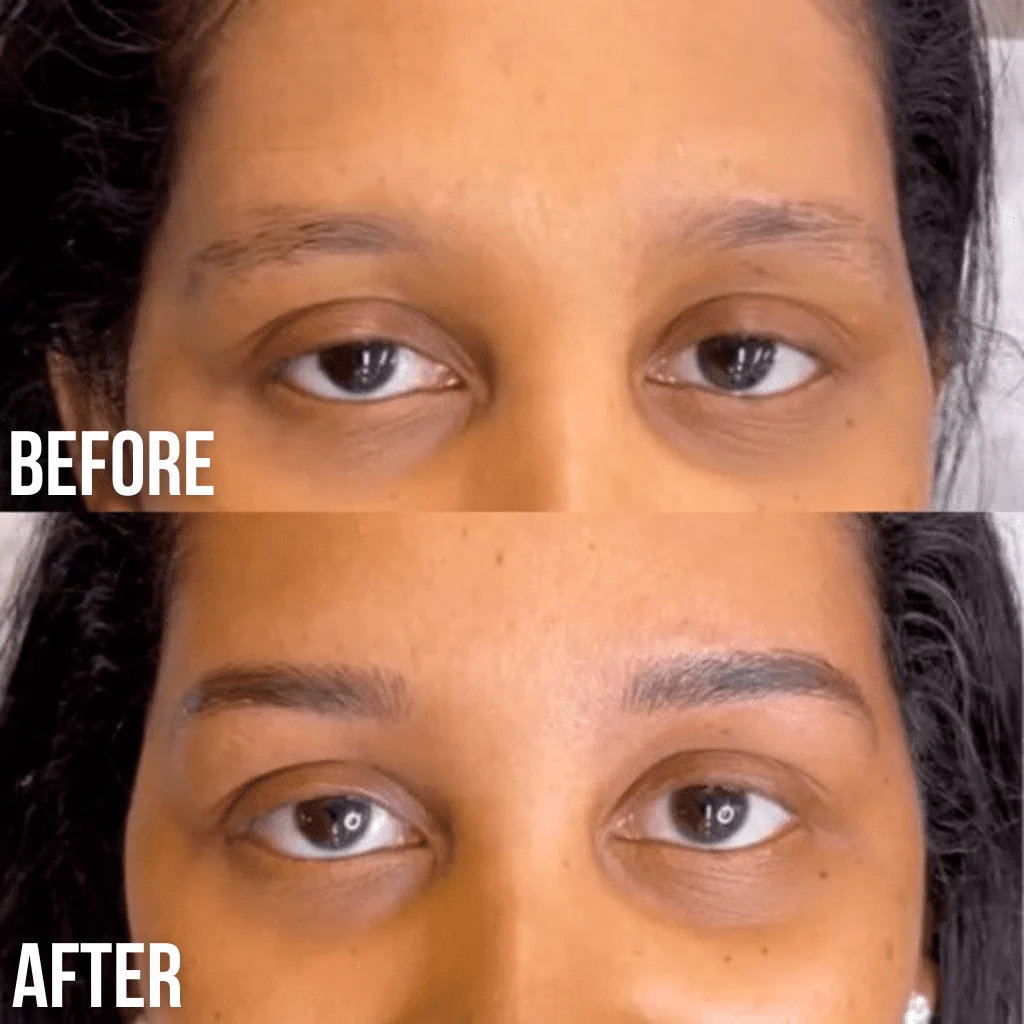 Eyebrow Growth Serum